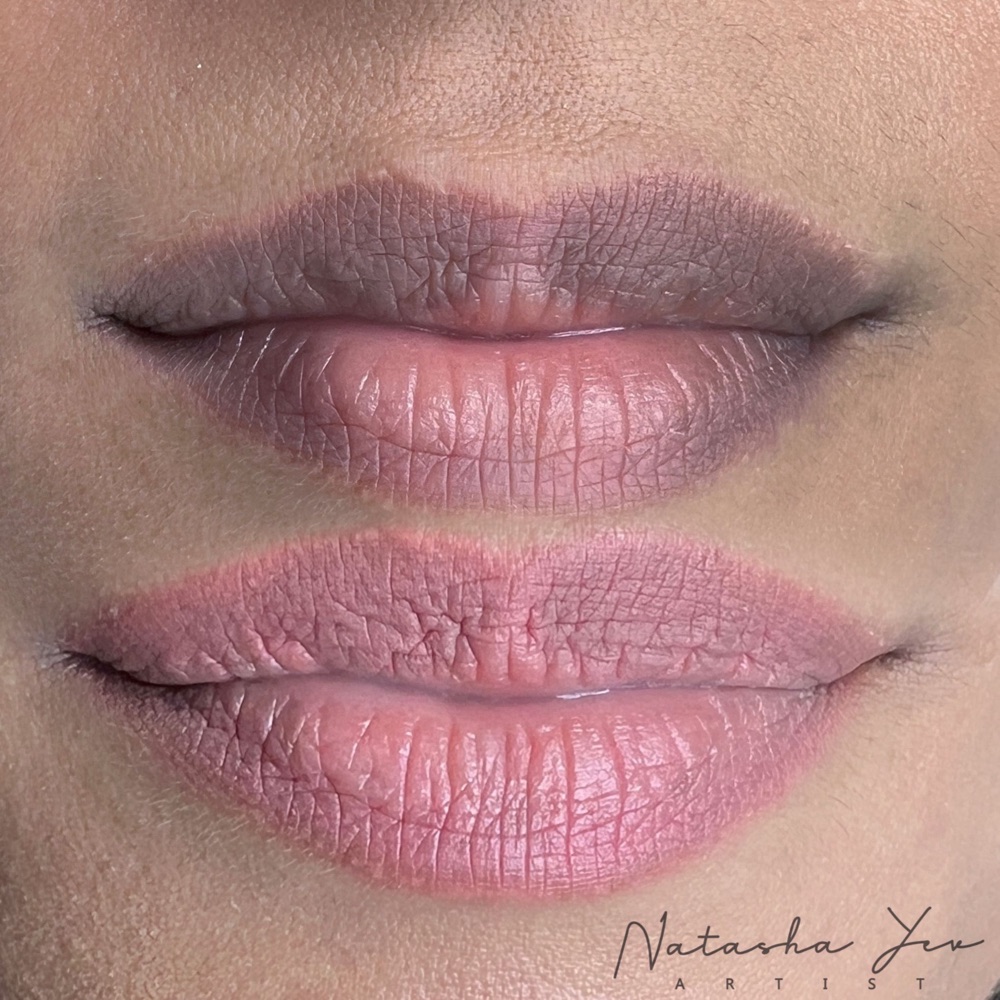 Dark lips neutralization, before and after